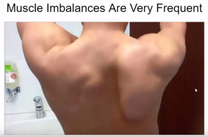 Shoulder Muscle Imbalance