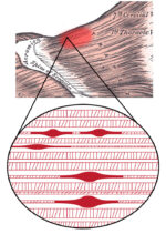 Trigger Point under microscope