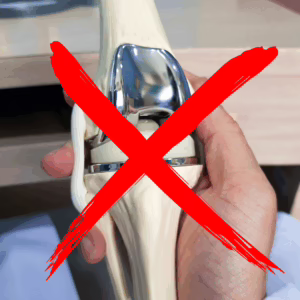 Avoid knee replacement surgery
