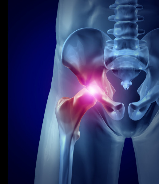 hip pain tendonitis bursitis